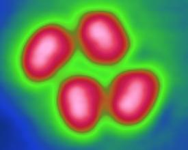 自動定量粉劑包裝機(jī)包裝精度第4篇：物料的粘結(jié)性對包裝精度的影響